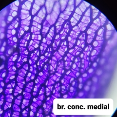 Sphagnum teres