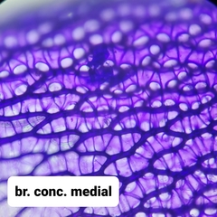 Sphagnum teres