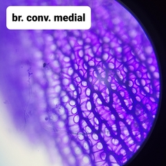 Sphagnum teres