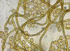 Hemitrichia lutescens