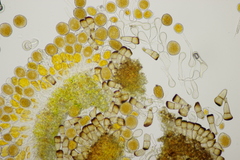 Puccinia pygmaea