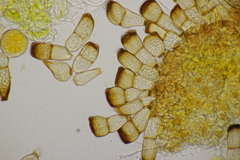 Puccinia pygmaea