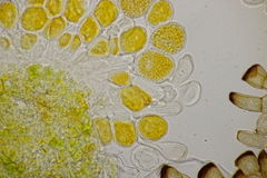 Puccinia pygmaea