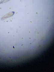 Paramecium