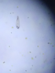 Paramecium