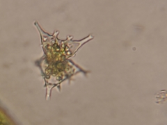 Staurastrum vestitum