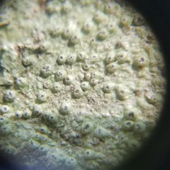 Pertusaria sinusmexicani