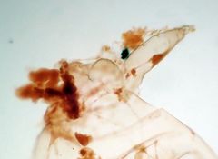 Acyrthosiphon macrosiphum