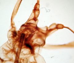 Acyrthosiphon macrosiphum