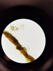 Vorticella