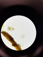 Vorticella