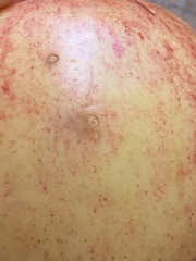 Rhagoletis pomonella