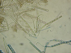 Wynnea sparassoides