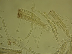 Wynnea sparassoides