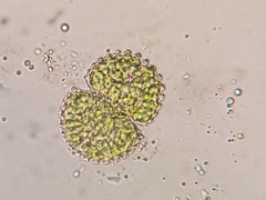 Cosmarium brebissonii