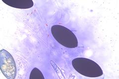 Podospora austrohemisphaerica