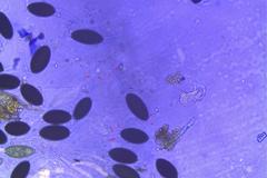 Podospora austrohemisphaerica