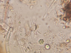 Xanthidium octocorne