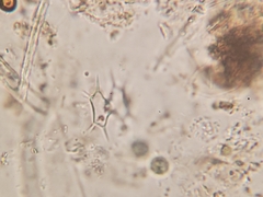 Xanthidium octocorne