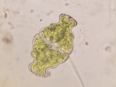 Euastrum ampullaceum