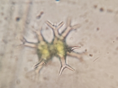 Staurastrum arctiscon