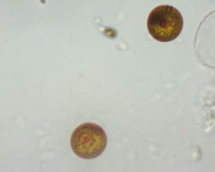 Trachelomonas cervicula