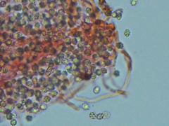 Trechispora mollusca