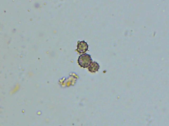 Tomentella lateritia