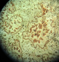 Arthonia cinnabarina