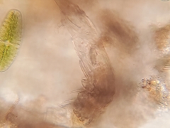 Dissotrocha aculeata