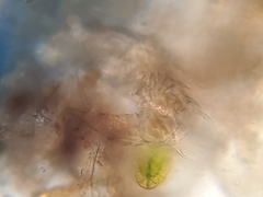 Dissotrocha aculeata