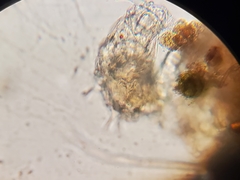 Dissotrocha aculeata