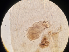 Dissotrocha aculeata