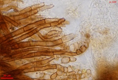 Trichophaea gregaria