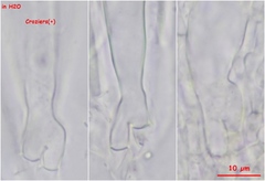 Trichophaea gregaria