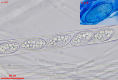 Trichophaea gregaria