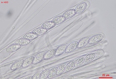 Trichophaea gregaria