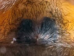 Cheiracanthium erraticum