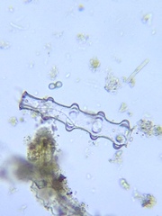 Pleurotaenium nodosum