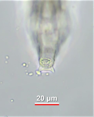 Macrotrachela decora