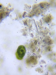 Cosmarium contractum