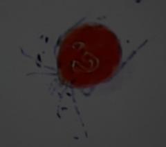 Hydrachnidae