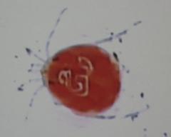 Hydrachnidae