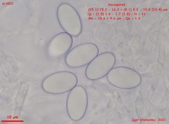 Trichophaeopsis bicuspis