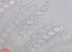 Trichophaeopsis bicuspis