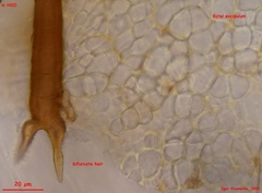 Trichophaeopsis bicuspis