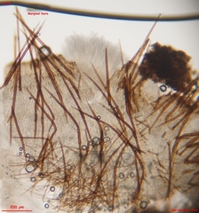 Trichophaeopsis bicuspis