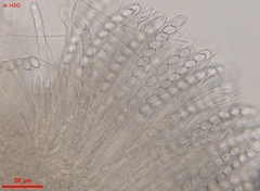 Trichophaeopsis bicuspis