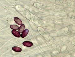 Ascobolus sacchariferus