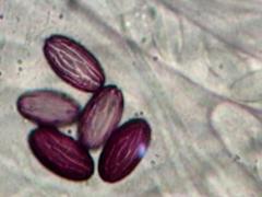 Ascobolus sacchariferus